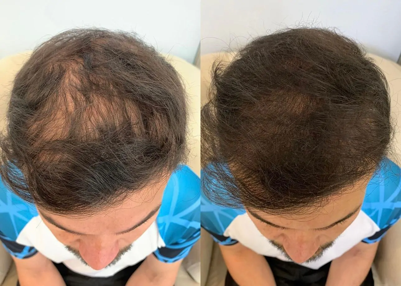 2f272852-78e4-4284-9f85-cf10724dd50f