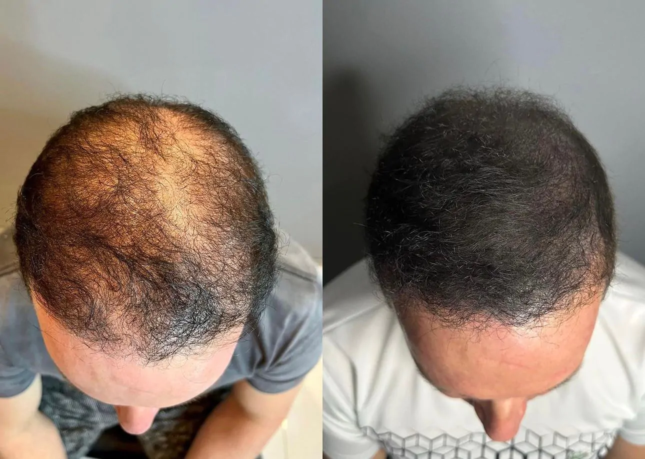 5b37da2b-63bd-4f48-8fff-85b1b938e182