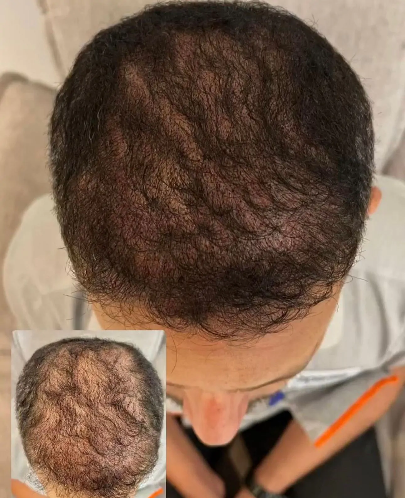 9546f3c5-8000-4dd9-bd3a-f11c7b28af6b