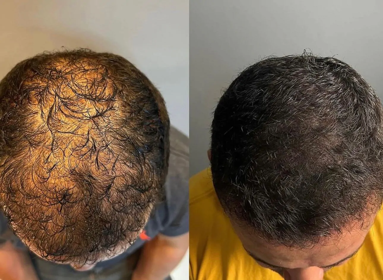 9c61aade-f385-4011-8b5f-a55356b91aed