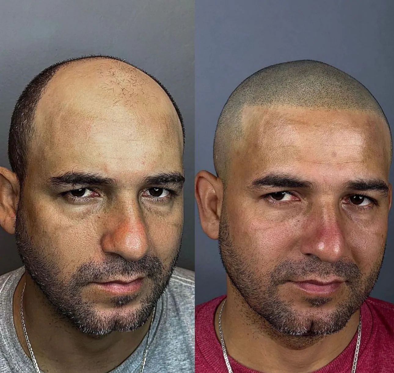 a21a4d13-e77f-45dc-8c43-82c06f2d9a4a