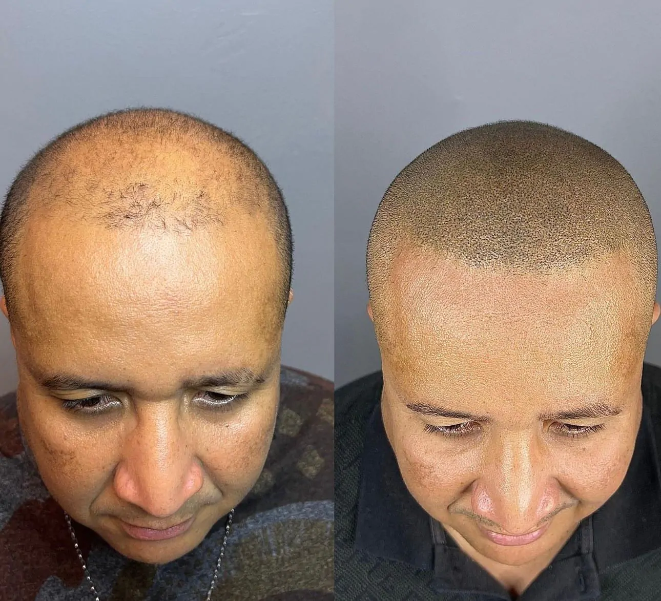 b923615a-79d6-48c4-b138-cb96a83b2fc2