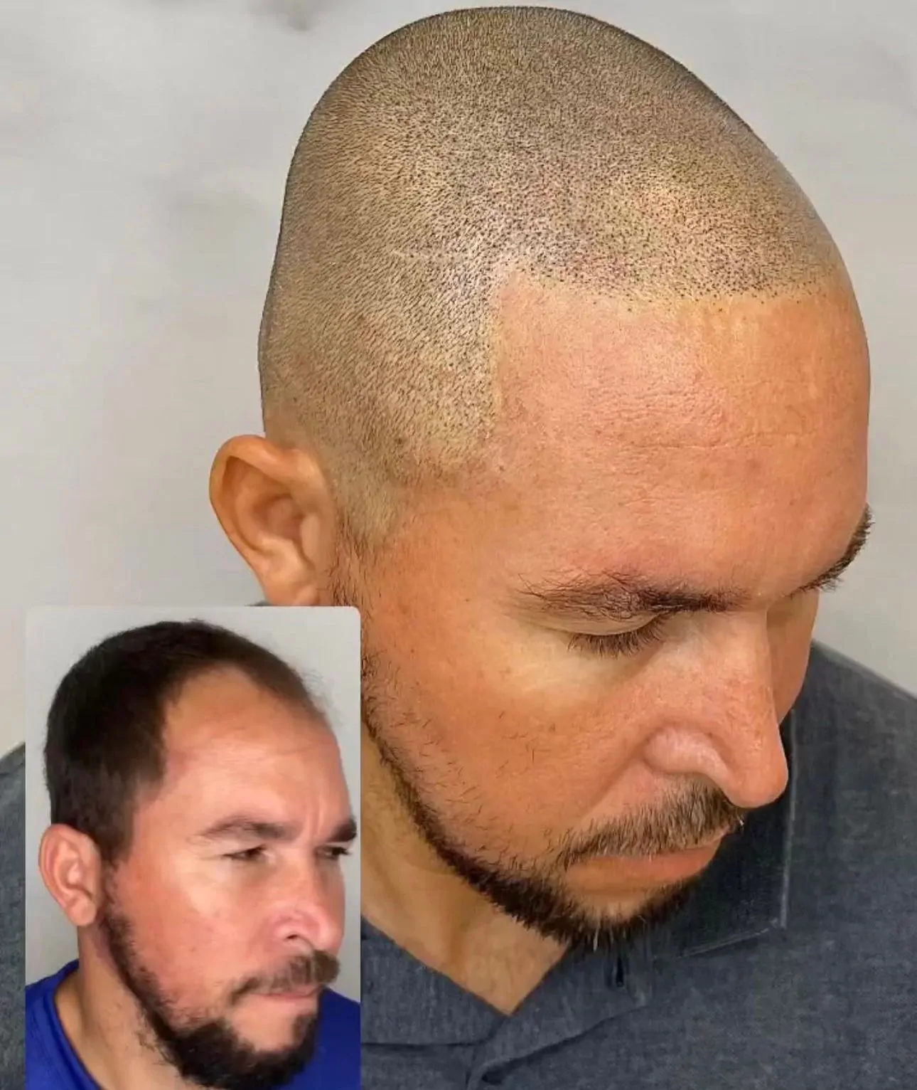 eb5c78c2-3a52-4995-b60f-f8dbddd2305f