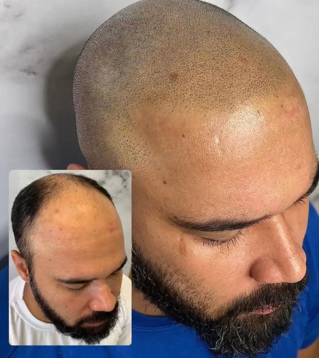 f8664a85-0b55-4462-b779-ef5c4997b1d1